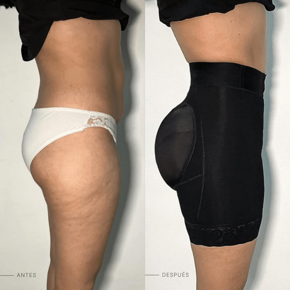 Short Levanta Glúteos - BELLACURVA MX