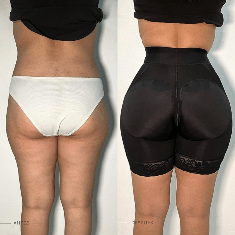 Short Levanta Glúteos - BELLACURVA MX